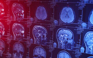 New AI tool could enhance and personalise brain tumour imaging