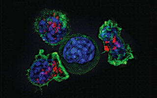 New CAR-T cell therapy gives hope for patients with aggressive blood cancer