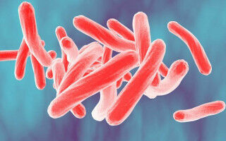 New classification of tuberculosis to support efforts to eliminate the disease