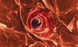 New clinical trial to treat skin disorder begins