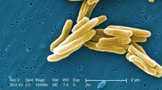 � 2012 Microbe World