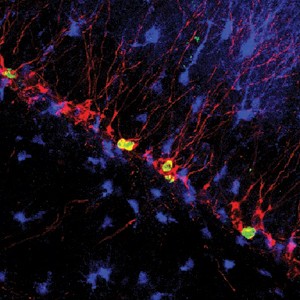 The figure shows newly born nerve cells  (green) colocalizing with a neuronal ma
