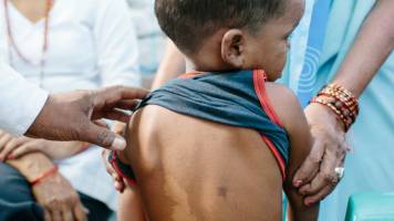 New Partnership to Achieve Zero Leprosy