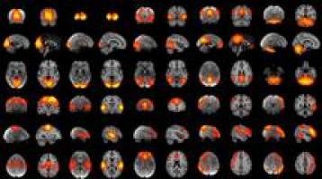 New treatments for mental illness under threat