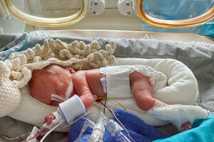 On the spot when life begins too early