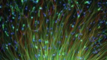 Pluripotent stem cells: medical dream or ethical nightmare?