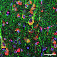 Potential target for MS therapy discovered