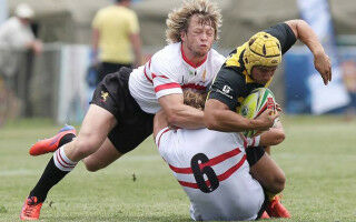 Professional rugby may be associated with changes in brain structure