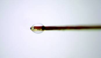 Reading our brain chemistry