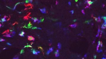 Reprogramming tumor-promoting macrophages for anti-cancer therapy