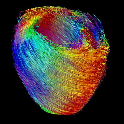 &rsquo;Muscle
fibres of the heart&rsquo;, by PhD student Laurence Jackson (UCL M