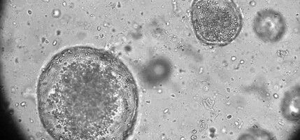 Results for: Vet med researcher takes transcontinental trip and transdisciplinary approach to tissue reuse