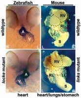 Scientists find gene linked to congenital heart defect
