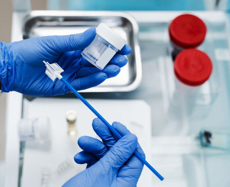 Medical professional holding a cytology test and cytobrush.