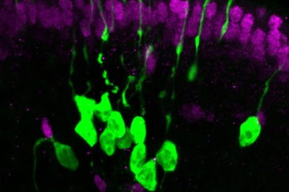 Neurons (green) derived from a single stem cell in the olfactory epithelium of t