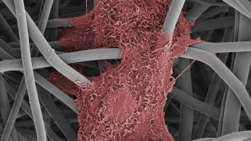 Sustainable biomedical textiles for the