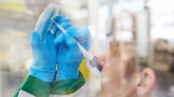 Swiss TPH Is Awarded Three New Grants from the Botnar Research Centre for Child Health to Combat COVID-19