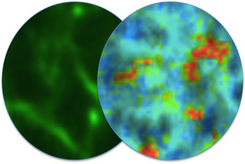 Part of a human cell nucleus. Green fluorescence shows nuclear F-actin and the c