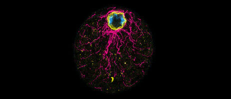 The egg or the chicken? An ancient unicellular says egg!