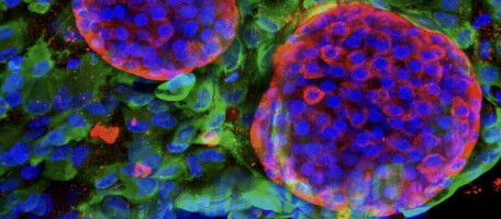 The EU highlights UNIGE's bioartificial pancreas project