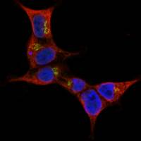 The STING of death in'T cells