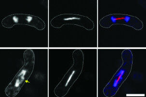 Time to part: how to produce sex cells with the right number of chromosomes