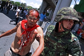 A Red Shirt protester bruised and bloodied on the Bangkok streets last year. Pho