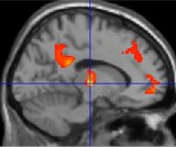 Diagram showing the tranquil brain