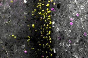 'Tug of war' between neurons tells the brain when to fear — and when not to be afraid