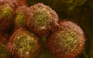 UCL backed pancreatic cancer therapy cleared for clinical trials