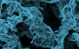 UCL spinout expands international licensing agreement for new bowel disease therapies