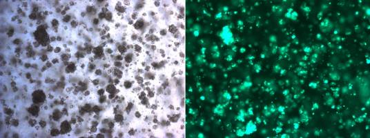 Using 3D cell cultures to fight anti-cancer therapy resistance
