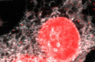 Watching how cells deal with stress