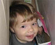 Children born with cleft often face unique challenges. This study will help answ