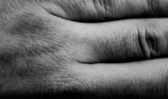 Zurich aims to extend high profile research on skin